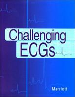 Challenging ECGs 1560535474 Book Cover