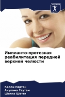 Импланто-протезная ... 6206032515 Book Cover