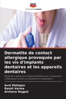 Dermatite de contact allergique provoquée par les vis d'implants dentaires et les appareils dentaires (French Edition) 6630244656 Book Cover