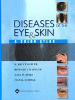 Diseases of the Eye and Skin: A Color Atlas 0781749999 Book Cover