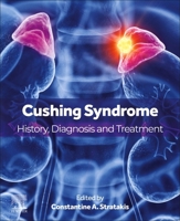 Cushing Syndrome: History, Diagnosis and Treatment 0323961002 Book Cover