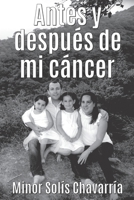 Antes y después de mi cáncer 9968493635 Book Cover