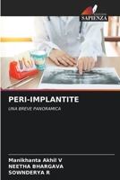 Peri-Implantite 6207382951 Book Cover