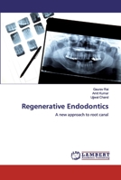 Regenerative Endodontics: A new approach to root canal 620048290X Book Cover