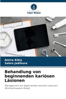 Behandlung von beginnenden kariösen Läsionen (German Edition) 6207714199 Book Cover