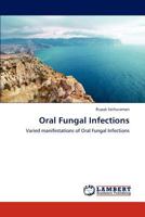 Oral Fungal Infections: Varied manifestations of Oral Fungal Infections 3659183350 Book Cover