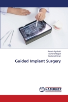 Guided Implant Surgery 6205514478 Book Cover