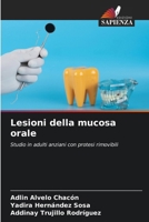 Lesioni della mucosa orale (Italian Edition) 6208301521 Book Cover