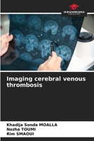 Imaging cerebral venous thrombosis 6208531586 Book Cover