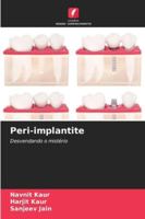 Peri-implantite (Portuguese Edition) 6209338011 Book Cover
