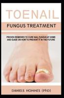 Toenail Fungus Treatment: Proven Remedies to Cure Nail Fungus at Home and Guide on How to Prevent It in the Future 1076855377 Book Cover