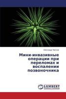 Mini-Invazivnye Operatsii Pri Perelomakh I Vospalenii Pozvonochnika 3659502685 Book Cover