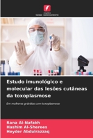 Estudo imunológico e molecular das lesões cutâneas da toxoplasmose (Portuguese Edition) 6208258863 Book Cover