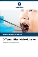 Offener Biss Malokklusion: Diagnose und Behandlung (German Edition) 6206432890 Book Cover