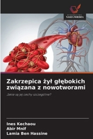 Zakrzepica zyl glebokich zwiazana z nowotworami (Polish Edition) 6209545726 Book Cover