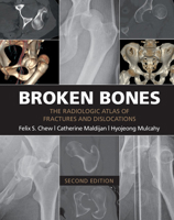 Broken Bones: The Radiologic Atlas of Fractures and Dislocations 1107499232 Book Cover