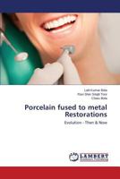 Porcelain fused to metal Restorations 3659240427 Book Cover