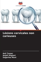 Lésions cervicales non carieuses (French Edition) 6208061954 Book Cover