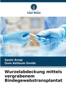 Wurzelabdeckung mittels vergrabenem Bindegewebstransplantat (German Edition) 6630435478 Book Cover