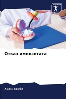 Отказ имплантата 6206227995 Book Cover