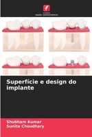 Superfície e design do implante (Portuguese Edition) 6207906845 Book Cover