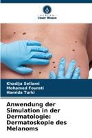 Anwendung der Simulation in der Dermatologie: Dermatoskopie des Melanoms 6206892972 Book Cover