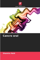 Cancro orale 620415785X Book Cover