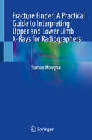 Fracture Finder: A Practical Guide to Interpreting Upper and Lower Limb X-Rays for Radiographers 303217323X Book Cover