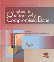 Implants in Qualitatively Compromised Bone 1850970505 Book Cover