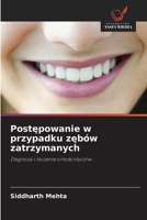 Postepowanie w przypadku zebów zatrzymanych (Polish Edition) 620954858X Book Cover