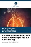Knochentuberkulose - von der Epidemiologie bis zur Behandlung (German Edition) 6630045742 Book Cover