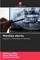 Mordida aberta: Diagnóstico e Modalidades de Tratamento 6204020307 Book Cover