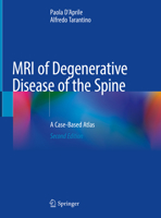 MRI of Degenerative Disease of the Spine: A Case-Based Atlas null Book Cover