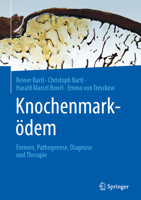 Knochenmarködem: Fortschritte in Diagnostik Und Therapie 3662671336 Book Cover
