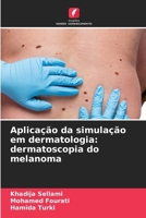 Aplicação da simulação em dermatologia: dermatoscopia do melanoma 6206893073 Book Cover