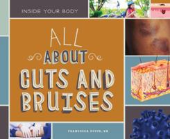 All about Cuts and Bruises 1532111185 Book Cover