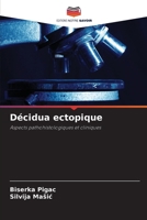 Décidua ectopique (French Edition) 6208909902 Book Cover