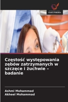Czestosc wystepowania zebów zatrzymanych w szczece i zuchwie - badanie (Polish Edition) 6630304381 Book Cover
