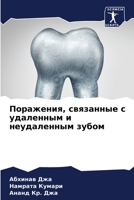 Поражения, связанные с удаленным и неудаленным зубом 6206128059 Book Cover