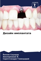 Дизайн имплантата 6206974421 Book Cover