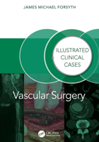 Vascular Surgery:: Illustrated Clinical Cases 1032804823 Book Cover