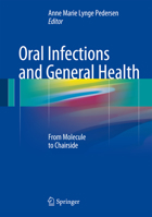 Oral Infections and General Health: From Molecule to Chairside 3319250892 Book Cover