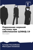 Поражение нервной системы при заболевании ЦОВИД-19: Монография 6206277682 Book Cover