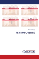Peri-Implantitis 620280212X Book Cover