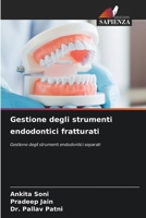 Gestione degli strumenti endodontici fratturati (Italian Edition) 6202423498 Book Cover