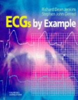 Ecgs by Example 0443056978 Book Cover