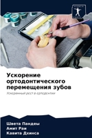 Ускорение ортодонтического перемещения зубов: Ускоренный рост в ортодонтии 6204061917 Book Cover