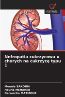 Nefropatia cukrzycowa u chorych na cukrzyce typu 1 (Polish Edition) 620947019X Book Cover