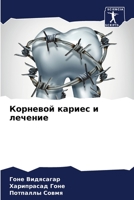 Корневой кариес и лечение 620607532X Book Cover