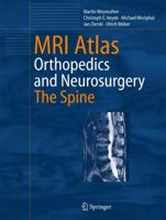 MRI Atlas: Orthopedics and Neurosurgery, the Spine 3642070159 Book Cover